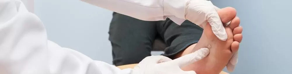 kurzajki profilaktyka